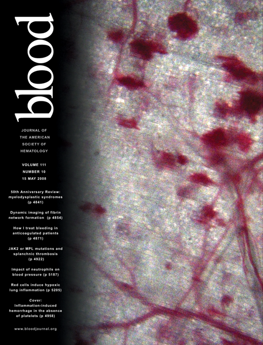 Blood Cover Image for Volume 111, Issue 10