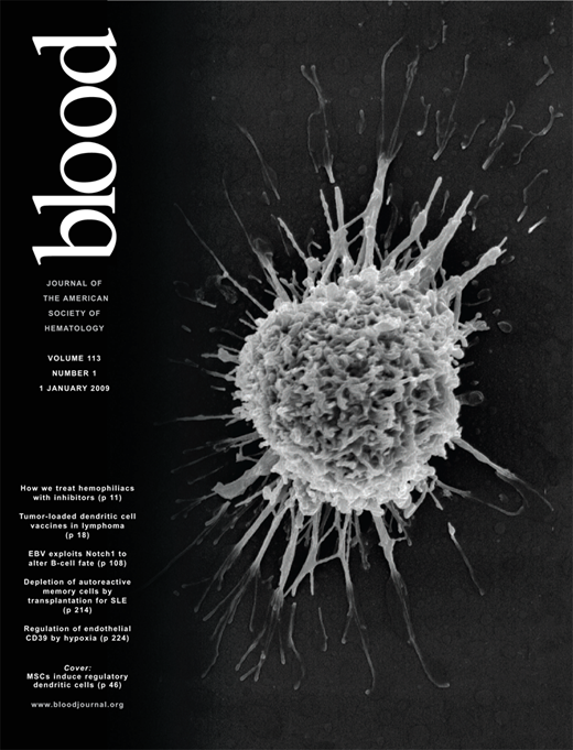 Blood Cover Image for Volume 113, Issue 1