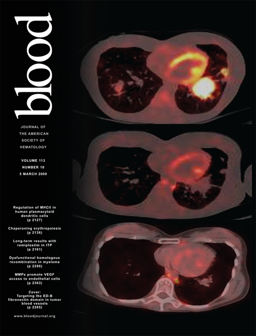 Blood Cover Image for Volume 113, Issue 10