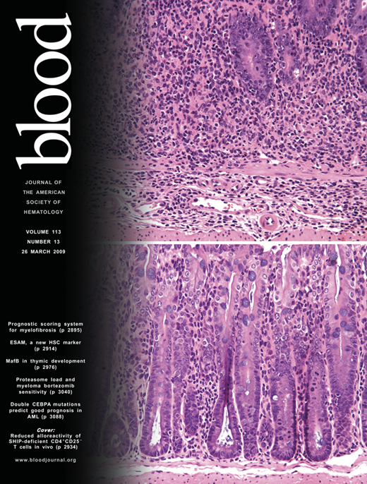Blood Cover Image for Volume 113, Issue 13