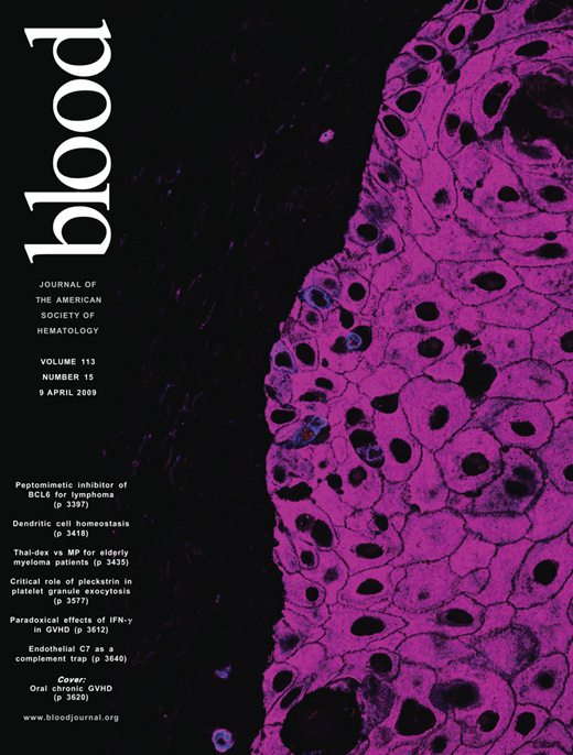 Blood Cover Image for Volume 113, Issue 15