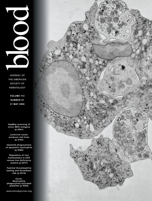 Blood Cover Image for Volume 113, Issue 21