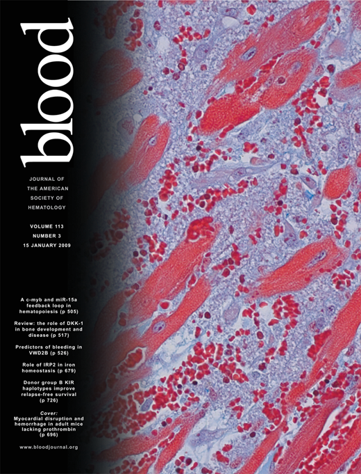 Blood Cover Image for Volume 113, Issue 3