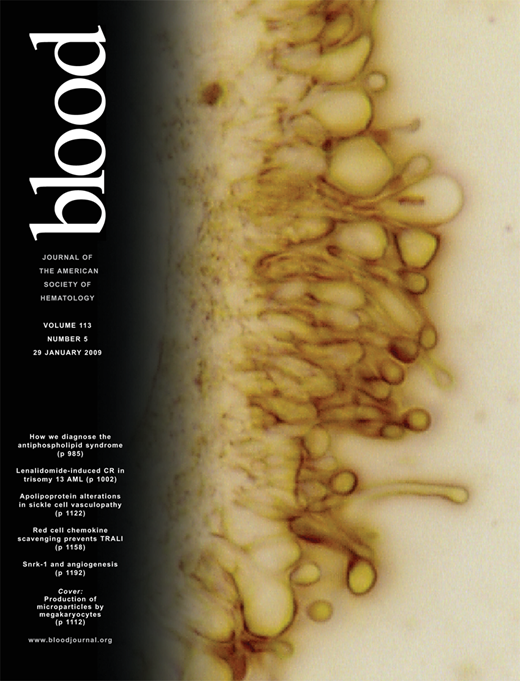 Blood Cover Image for Volume 113, Issue 5