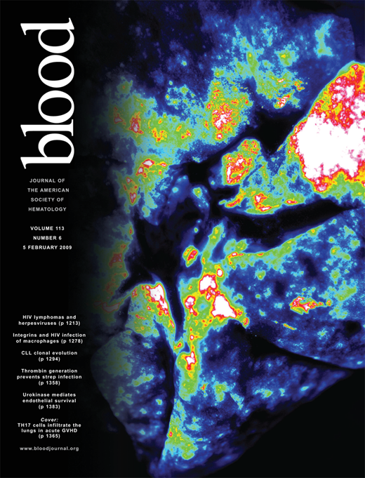 Blood Cover Image for Volume 113, Issue 6