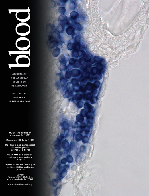 Blood Cover Image for Volume 113, Issue 8