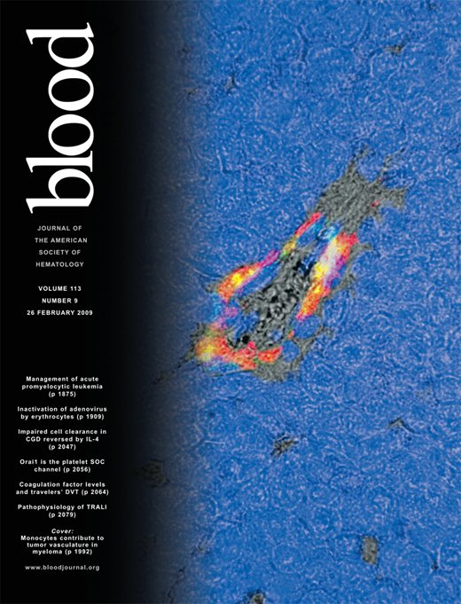 Blood Cover Image for Volume 113, Issue 9