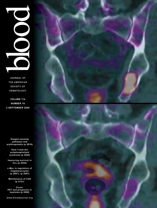 Blood Cover Image for Volume 114, Issue 10