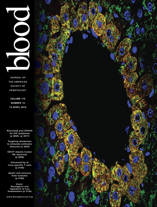 Blood Cover Image for Volume 115, Issue 15