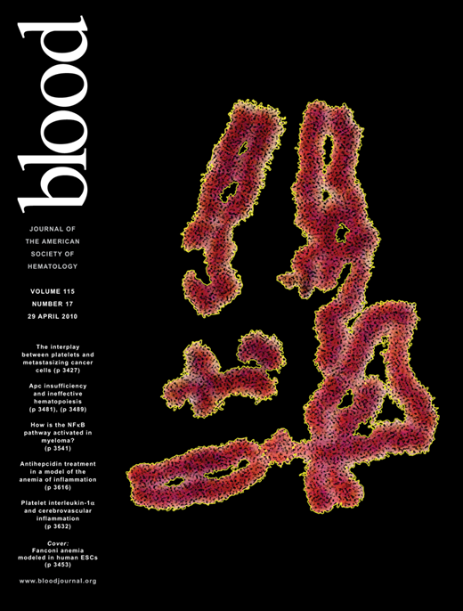 Blood Cover Image for Volume 115, Issue 17