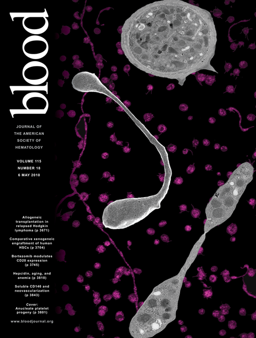 Blood Cover Image for Volume 115, Issue 18