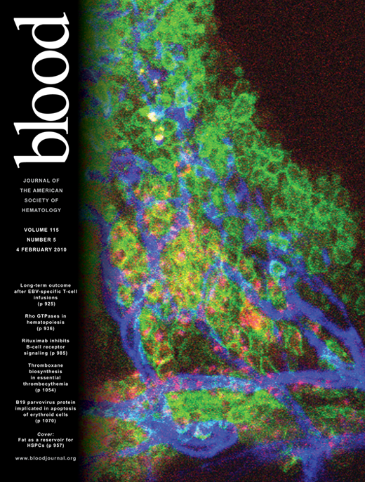 Blood Cover Image for Volume 115, Issue 5