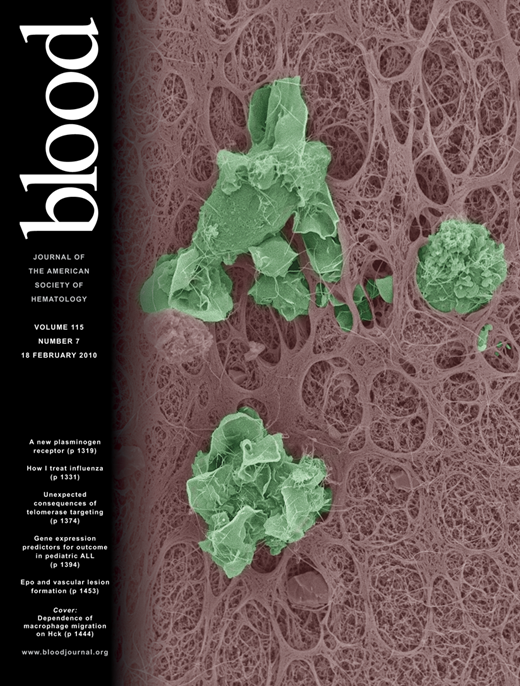 Blood Cover Image for Volume 115, Issue 7