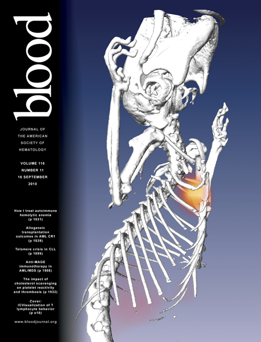 Blood Cover Image for Volume 116, Issue 11