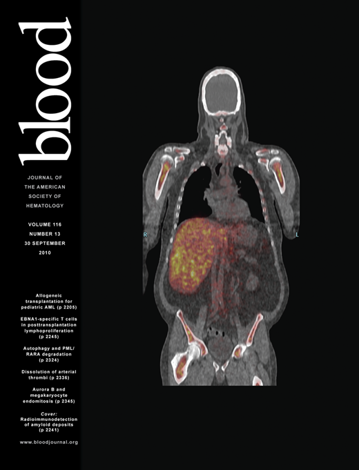 Blood Cover Image for Volume 116, Issue 13