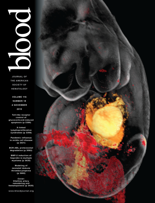 Blood Cover Image for Volume 116, Issue 18