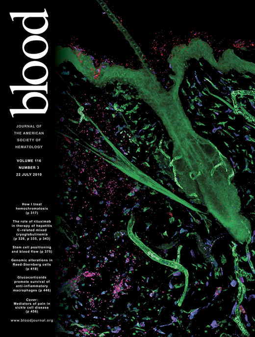 Blood Cover Image for Volume 116, Issue 3