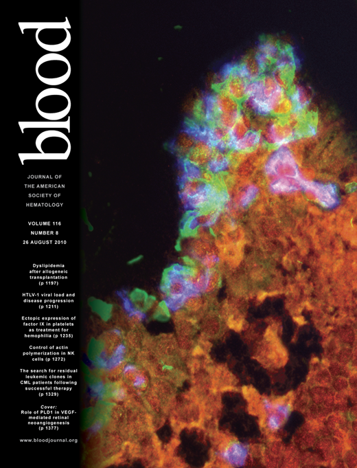 Blood Cover Image for Volume 116, Issue 8