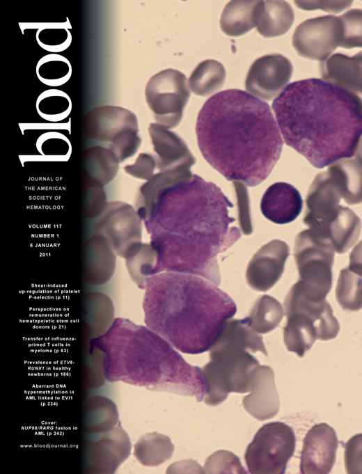 Blood Cover Image for Volume 117, Issue 1