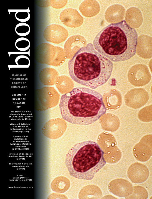 Blood Cover Image for Volume 117, Issue 10