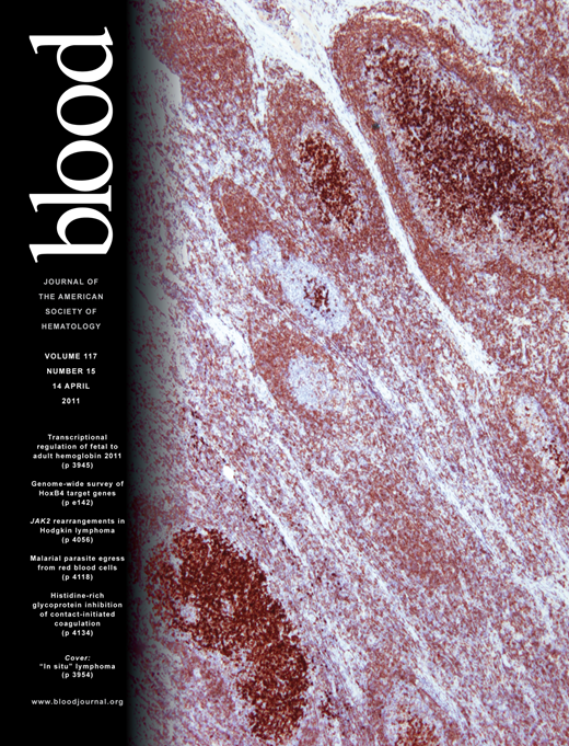 Blood Cover Image for Volume 117, Issue 15