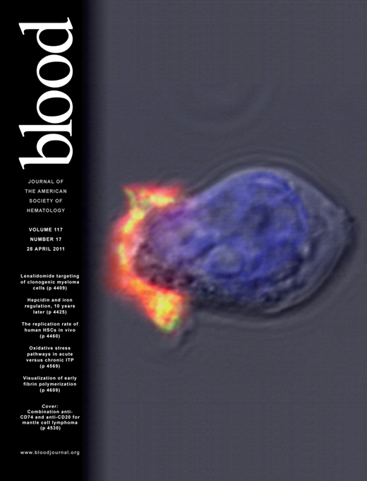 Blood Cover Image for Volume 117, Issue 17