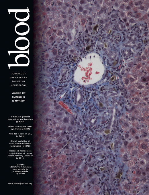 Blood Cover Image for Volume 117, Issue 20