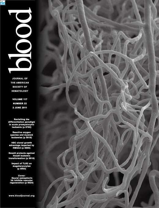 Blood Cover Image for Volume 117, Issue 22