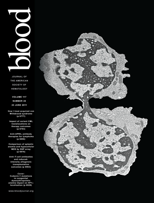 Blood Cover Image for Volume 117, Issue 25