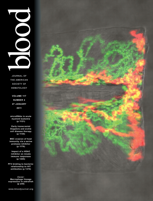 Blood Cover Image for Volume 117, Issue 4