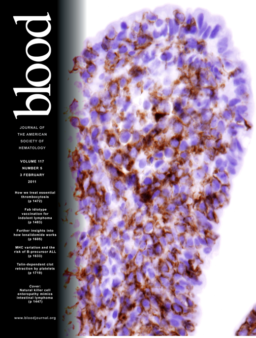 Blood Cover Image for Volume 117, Issue 5