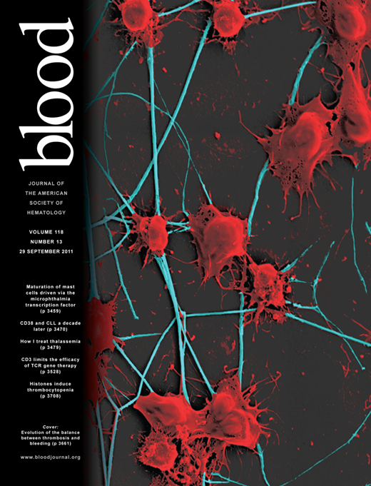 Blood Cover Image for Volume 118, Issue 13