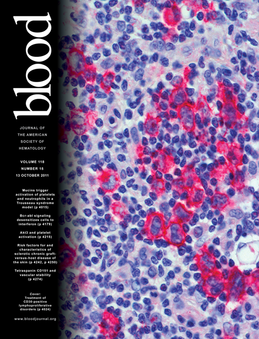 Blood Cover Image for Volume 118, Issue 15