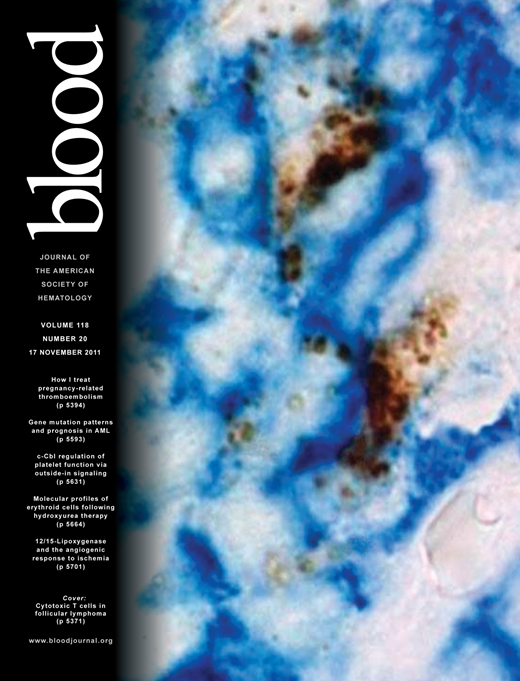 Blood Cover Image for Volume 118, Issue 20