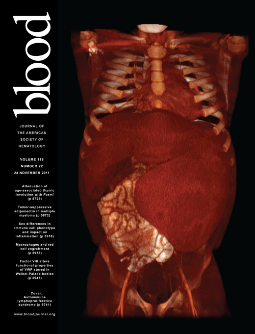 Blood Cover Image for Volume 118, Issue 22