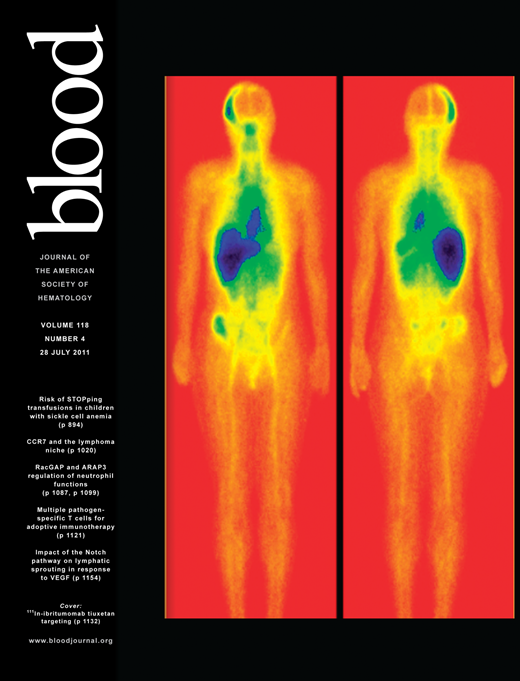 Blood Cover Image for Volume 118, Issue 4