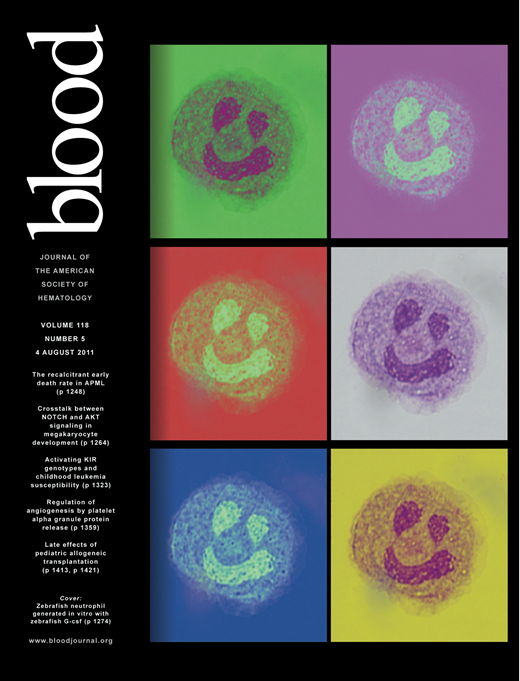 Blood Cover Image for Volume 118, Issue 5