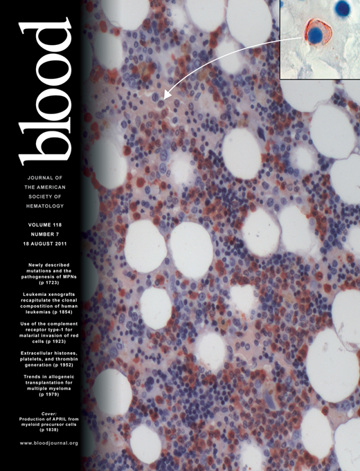 Blood Cover Image for Volume 118, Issue 7