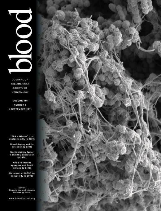 Blood Cover Image for Volume 118, Issue 9
