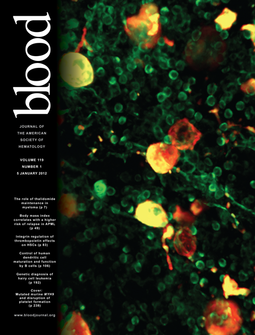Blood Cover Image for Volume 119, Issue 1