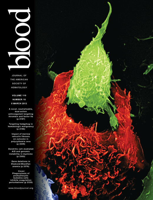 Blood Cover Image for Volume 119, Issue 10