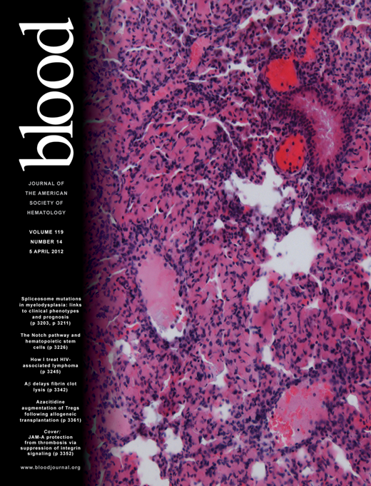 Blood Cover Image for Volume 119, Issue 14