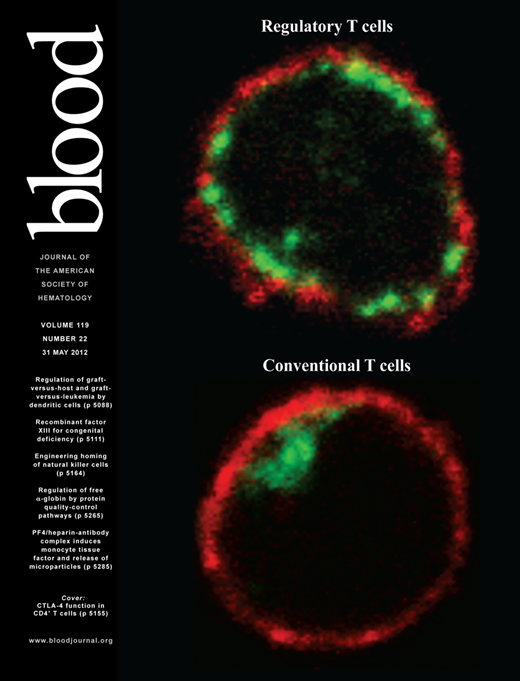 Blood Cover Image for Volume 119, Issue 22