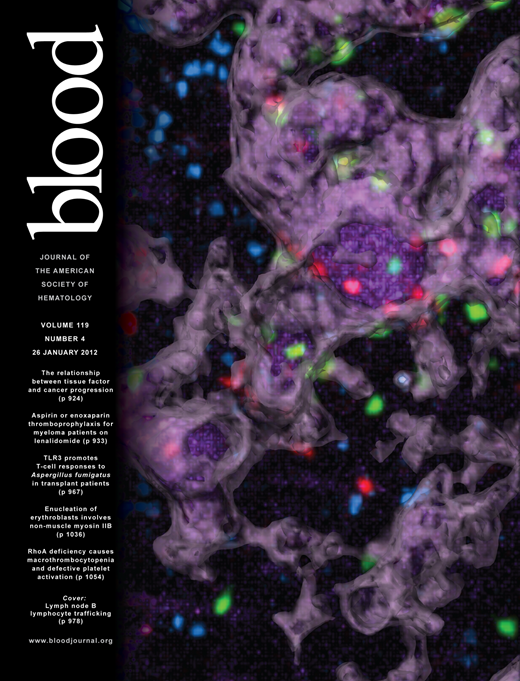 Blood Cover Image for Volume 119, Issue 4