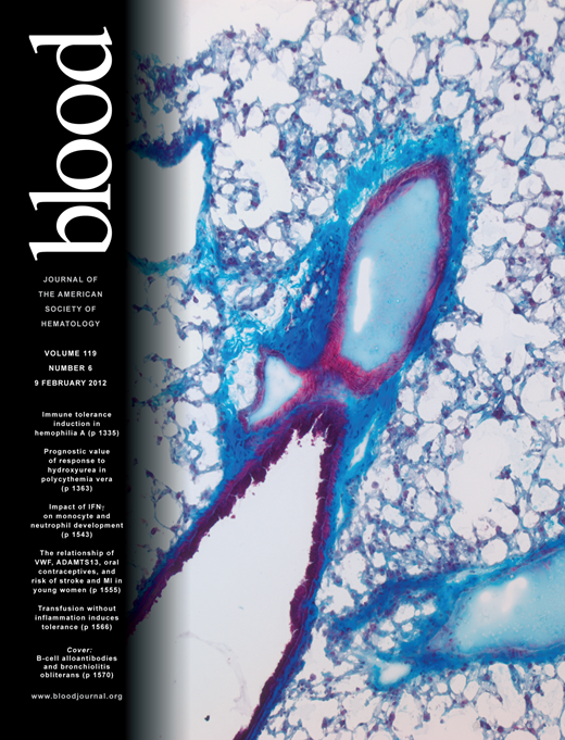 Blood Cover Image for Volume 119, Issue 6