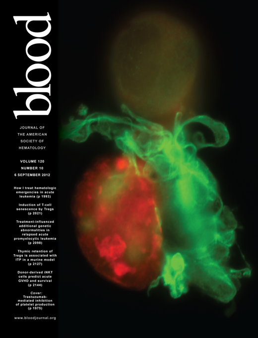 Blood Cover Image for Volume 120, Issue 10