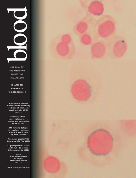 Blood Cover Image for Volume 120, Issue 16