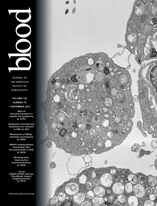 Blood Cover Image for Volume 120, Issue 18