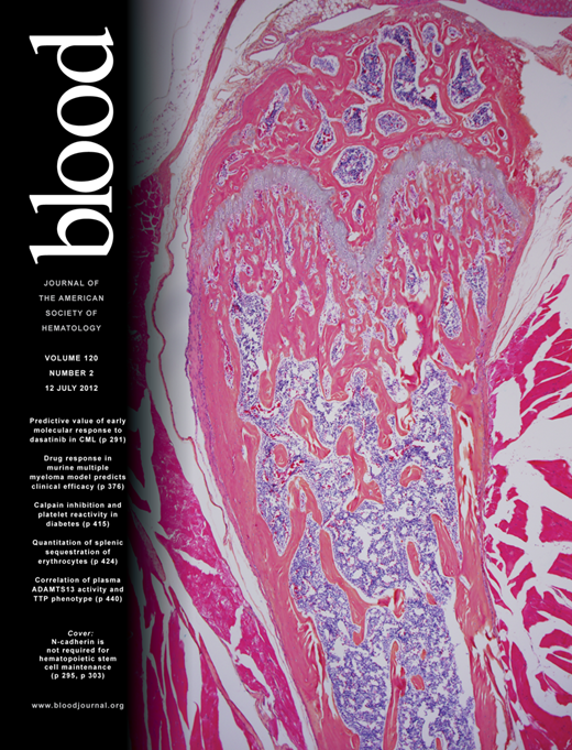 Blood Cover Image for Volume 120, Issue 2