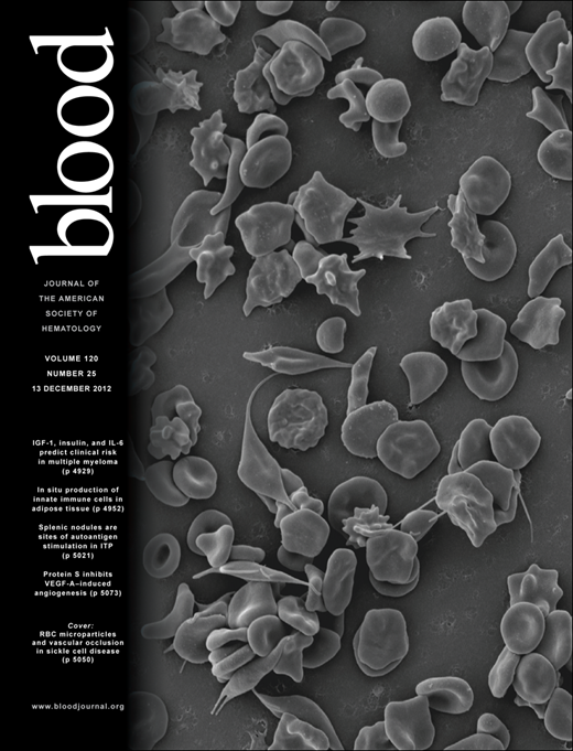 Blood Cover Image for Volume 120, Issue 25